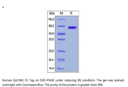 ACROBiosystems Recombinant Protein;Human EpCAM / TROP1 Protein, Fc Tag;HEK293;1MG;EPM,EPCAM,DIAR5,DIAR-5,EGP-2,EGP2,EGP314,EGP-314,EGP40,EGP-40,ESA,GA733-2,HNPCC8,HNPCC-8,KS1/4,KSA,M4S1,MIC18,MIC-18,MK-1,MK1,TACSTD1,TACSTD-1,TROP1,TROP-1,CD326,CD-326,
