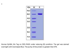 ACROBiosystems Recombinant Protein;Human EphB4 Protein;HEK293;1MG;EP4,EphB4,HTK,MYK1,TYRO11,EphB-4,MYK-1,