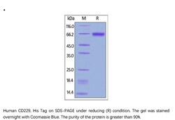ACROBiosystems Recombinant Protein;Human CD229 / SLAMF3 Protein;HEK293;100UG;CD9,CD229