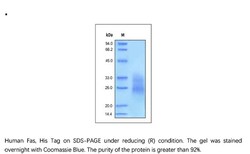 ACROBiosystems Recombinant Protein;Human Fas / TNFRSF6 / CD95 Protein;HEK293;50UG;FAS,FAS,ALPS1A,APO-1,APO1,APT1,APT-1,CD95,CD-95,FAS1,FAS-1,FASTM,TNFRSF6,TNFRSF-6,FasR
