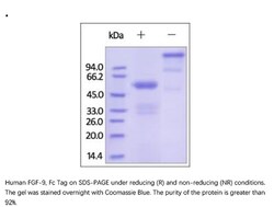 ACROBiosystems Recombinant Protein;Human FGF-9 Protein, Fc Tag;HEK293;100UG;FG9,FGF9,FGF-9,GAF,HBFG-9,HBFG9,MGC119914,MGC119915,SYNS3,