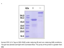 ACROBiosystems Recombinant Protein;Human FGF-9 Protein, Fc Tag;HEK293;1MG;FG9,FGF9,FGF-9,GAF,HBFG-9,HBFG9,MGC119914,MGC119915,SYNS3,