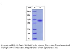 ACROBiosystems Recombinant Protein;Cynomolgus CD38 Protein;HEK293;1MG;CD8,CD38,T10,cADPr