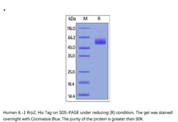 ACROBiosystems Recombinant Protein;Human IL-1 Rrp2 / IL-1 R6 Protein;HEK293;1MG;IL2,IL-1