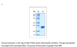 ACROBiosystems Recombinant Protein;Human Lipocalin-2 / NGAL Protein;HEK293;100UG;LC2,NGAL,LCN2,Lipocalin-2,24p3,MSFI,LCN-2,Lipocalin