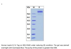 ACROBiosystems Recombinant Protein;Human Leptin R / CD295 Protein, Fc Tag;HEK293;100UG;LER,LEPR,CD295,DKFZp686B1731,LEP-R,OB-R,OBR,Leptin