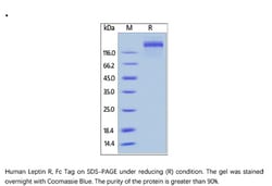 ACROBiosystems Recombinant Protein;Human Leptin R / CD295 Protein, Fc Tag;HEK293;250UG;LER,LEPR,CD295,DKFZp686B1731,LEP-R,OB-R,OBR,Leptin