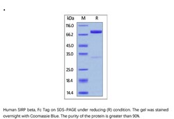 ACROBiosystems Recombinant Protein;Human SIRP beta / CD172b Protein, Fc