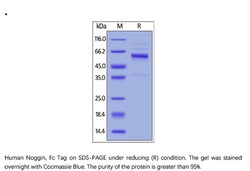 ACROBiosystems Recombinant Protein;Human Noggin Protein, Fc Tag;HEK293;100UG;NON,Noggin,NOG,SYM1,SYM-1,SYNS1,SYNS-1,