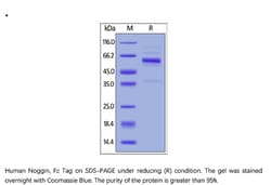 ACROBiosystems Recombinant Protein;Human Noggin Protein, Fc Tag;HEK293;1MG;NON,Noggin,NOG,SYM1,SYM-1,SYNS1,SYNS-1,