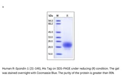 ACROBiosystems Recombinant Protein;Human R-Spondin 1 / RSPO1 (21-146) Protein;HEK293;1MG;RS6,RSPO1,RSPO-1,CRISTIN3,CRISTIN-3,FLJ40906,RP11-566C13.1,RSPO,R-spondin-1,Rspondin-1,Rspondin1,Rspondin,