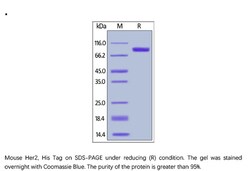 ACROBiosystems Recombinant Protein;Mouse Her2 / ErbB2 Protein;HEK293;1MG;ER2,ERBB2,CD340,HER-2,HER-2/neu,HER2,MLN19,NEU,NGL,TKR1,ERBB-2,MLN-19,TKR-1,
