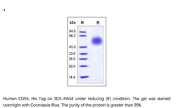 ACROBiosystems Recombinant Protein;Human CD55 / DAF Protein;HEK293;100UG;CD5,CD55,DAF,CR,CROM,TC,