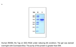 ACROBiosystems Recombinant Protein;Human RENIN Protein;HEK293;1MG;REN,RENIN,REN,HNFJ2,FLJ10761,angiotensinogenase,