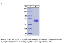 ACROBiosystems Recombinant Protein;Human TIMP1 Protein;HEK293;1MG;TI1,TIMP1,TIMP-1,CLGI,EPA,EPO,FLJ90373,HCI,TIMP,TIMP1M,RP1-230G1.3,