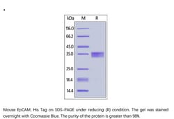 ACROBiosystems Recombinant Protein;Mouse EpCAM / TROP1 Protein;HEK293;1MG;EPM,EPCAM,DIAR5,DIAR-5,EGP-2,EGP2,EGP314,EGP-314,EGP40,EGP-40,ESA,GA733-2,HNPCC8,HNPCC-8,KS1/4,KSA,M4S1,MIC18,MIC-18,MK-1,MK1,TACSTD1,TACSTD-1,TROP1,TROP-1,CD326,CD-326,