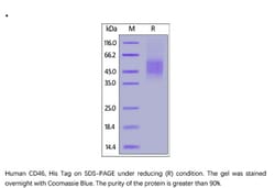 ACROBiosystems Recombinant Protein;Human CD46 Protein;HEK293;50UG;CD6,CD46,AHUS2,MCP,MIC10,TLX,TRA2.10,