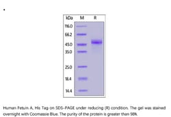 ACROBiosystems Recombinant Protein;Human Fetuin A / FETUA Protein;HEK293;1MG;FEA,AHSG,FETUA,Fetuin