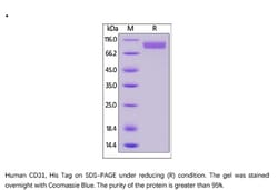 ACROBiosystems Recombinant Protein;Human CD31 / PECAM-1 Protein;HEK293;1MG;CD1,PECAM1,PECAM-1,CD31,CD-31,FLJ34100,FLJ58394,PECAM,