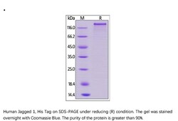 ACROBiosystems Recombinant Protein;Human Jagged 1 / JAG1 Protein;HEK293;1MG;JA1,CD339,JAG1,Jagged1,hJ1,Jagged-1,JAGL1,JAG-1,