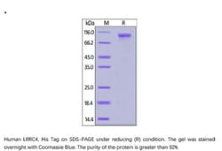 ACROBiosystems Recombinant Protein;Human LRRC4 Protein;HEK293;1MG;LR4,LRRC4,NGL-2,BAG,NAG14,NGL2,LRRC-4,Netrin-G2