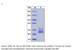ACROBiosystems Recombinant Protein;Human CD69 / CLEC2C Protein;HEK293;100UG;CD9,CD69,CLEC2C,AIM,BL-AC/P26,EA1,GP32/28,MLR-3,