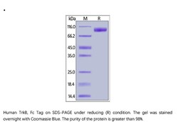 ACROBiosystems Recombinant Protein;Human TrkB / NTRK2 Protein, Fc Tag;HEK293;1MG;NT2,NTRK2,TRKB,NTRK-2,TRK-B,GP145-TrkB,