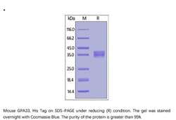 ACROBiosystems Recombinant Protein;Mouse GPA33 / A33 Protein;HEK293;50UG;GP3,GPA33,A33,GP-A33,