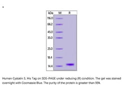 ACROBiosystems Recombinant Protein;Human Cystatin S / CST4 Protein;HEK293;100UG;CS4,CST4,Cystatin-4,Cystatin-S,Cystatin-S5,CST-4,Cystatin-SA-III,Cystatin