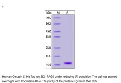 ACROBiosystems Recombinant Protein;Human Cystatin S / CST4 Protein;HEK293;1MG;CS4,CST4,Cystatin-4,Cystatin-S,Cystatin-S5,CST-4,Cystatin-SA-III,Cystatin