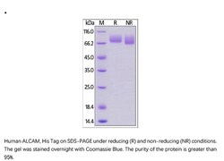 ACROBiosystems Recombinant Protein;Human ALCAM Protein;HEK293;1MG;CD6,CD166,ALCAM,CD6L,KG-CAM,MEMD,