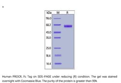 ACROBiosystems Recombinant Protein;Human PROCR / EPCR / CD201 Protein,