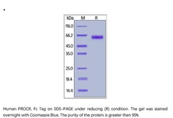 ACROBiosystems Recombinant Protein;Human PROCR / EPCR / CD201 Protein,