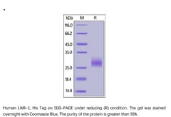 ACROBiosystems Recombinant Protein;Human LAIR1 / CD305 Protein, His Tag;HEK293;1MG;CD5,LAIR1,CD305,LAIR-1,