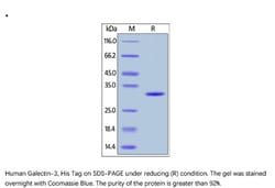 ACROBiosystems Recombinant Protein;Human Galectin-3 Protein;E.coli;1MG;GA3,Galectin-3,LGALS3,MAC2,Gal-3,35