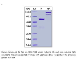 ACROBiosystems Recombinant Protein;Human Ephrin-A1 / EFNA1 Protein, Fc