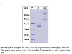 ACROBiosystems Recombinant Protein;Human Siglec-6 / CD327 Protein, Fc Tag;HEK293;1MG;SI6,SIGLEC6,CD327,CD33L,CD33L1,OBBP1,OB-BP1,CDw327,SIGLEC-6,OBBP-1,