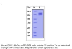 ACROBiosystems Recombinant Protein;Human ICAM-1 / CD54 Protein, His Tag;HEK293;1MG;IC1,ICAM1,ICAM-1,BB2,BB-2,CD54,CD-54,P3.58,