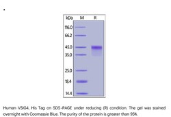 ACROBiosystems Recombinant Protein;Human VSIG4 Protein;HEK293;1MG;VS4,VSIG4,CRIg,Z39IG,VSIG-4,