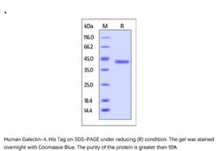 ACROBiosystems Recombinant Protein;Human Galectin-4 / LGALS4 / L36LBP Protein,