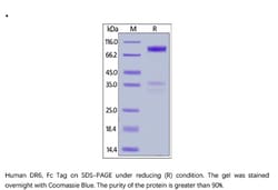 ACROBiosystems Recombinant Protein;Human DR6 / TNFRSF21 Protein, Fc Tag;HEK293;1MG;TN1,TNFRSF21,DR6,CD358,TNFRSF-21,DR-6,BM-018,BM018,
