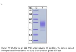 ACROBiosystems Recombinant Protein;Human PTH1R / PTHR1 Protein;HEK293;1MG;PTR,PTH1R,PTHR,PTHR1,PTH/PTHr