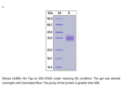 ACROBiosystems Recombinant Protein;Mouse LILRB4 / CD85k / ILT3 Protein,