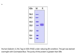 ACROBiosystems Recombinant Protein;Human Galectin-3 Protein;HEK293;1MG;GA3,Galectin-3,LGALS3,MAC2,Gal-3,35