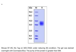 ACROBiosystems Recombinant Protein;Mouse B7-H5 / Gi24 / VISTA Protein;HEK293;1MG;B75,B7-H5,C10orf54,Sisp-1,SISP1,Gi24,VISTA,B7H5,