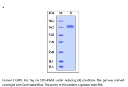 ACROBiosystems Recombinant Protein;Human LILRB5 / CD85c / LIR-8 Protein;HEK293;1MG;CDC,LILRB5,CD85c,LIR-8,LIR8,