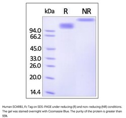 ACROBiosystems Recombinant Protein;Human SCARB1 / SR-B1 Protein, Fc Tag;HEK293;50UG;SC1,SCARB1,CD36L1,SRB1,CLA-1,SR-BI,CLA1,HDLQTL6,SCARB-1,SRB-1,SRBI,CD36