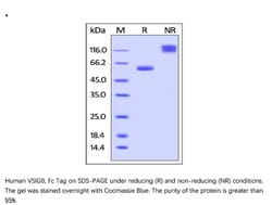 ACROBiosystems Recombinant Protein;Human VSIG8 Protein, Fc tag;HEK293;1MG;VS8,VSIG8,C1orf204,