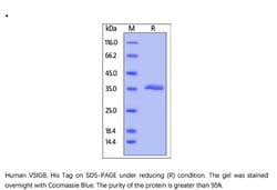 ACROBiosystems Recombinant Protein;Human VSIG8 Protein;HEK293;1MG;VS8,VSIG8,C1orf204,