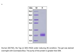 ACROBiosystems Recombinant Protein;Human SECTM1 Protein;HEK293;1MG;SE1,SECTM1,K12,SECTM-1,K-12,